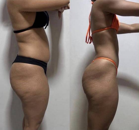 Antes e depois de aluna